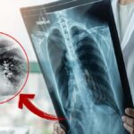 Gripten kurtuldunuz mu? Asıl tehlike şimdi başlıyor: “süper enfeksiyon” alarmı.