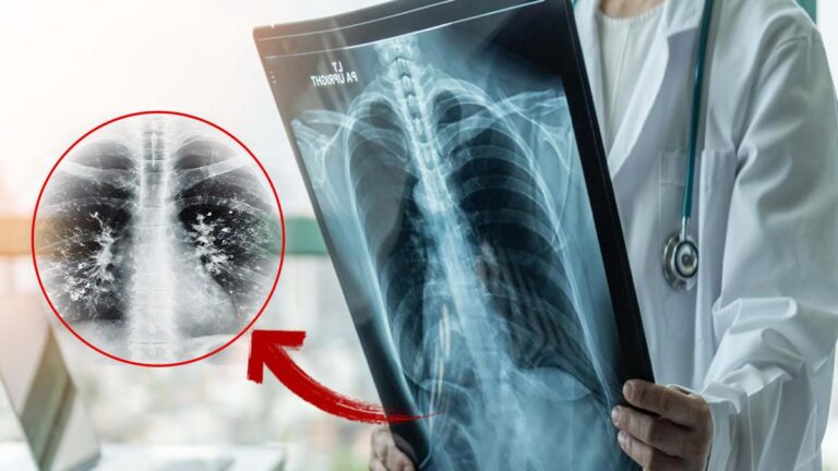 Gripten kurtuldunuz mu? Asıl tehlike şimdi başlıyor: “süper enfeksiyon” alarmı.